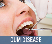 Gum Disease Specialist